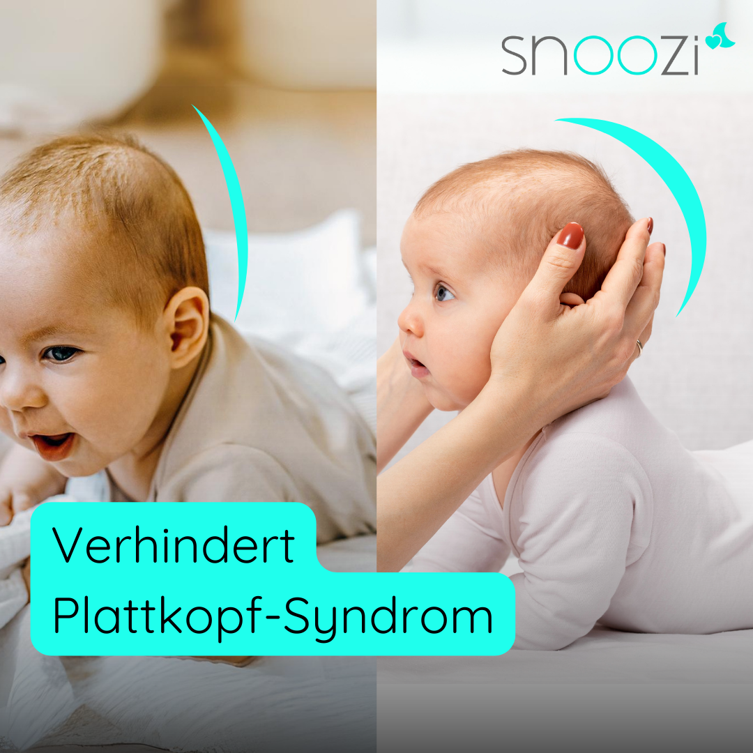 babykissen-plattkopf